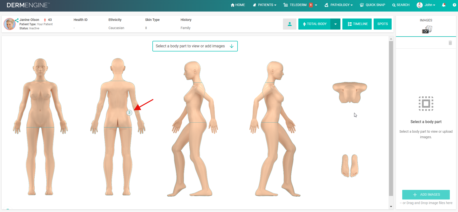 DermEngine  Total Body Photography