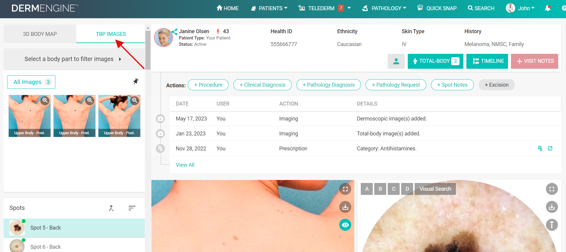 How Can I Access A Patient's Total Body Images From Their Spots Page? –  MetaOptima Technology Inc