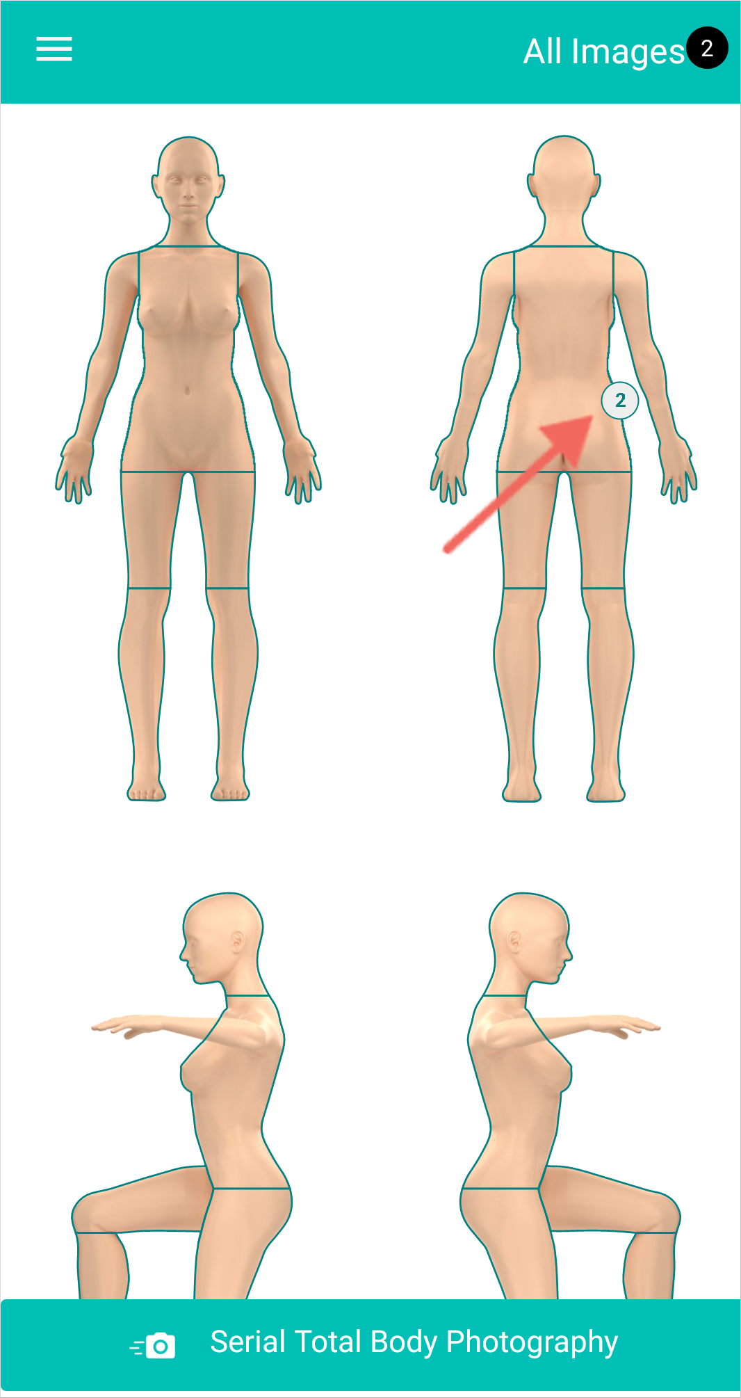 2._Select_Body_Part.png