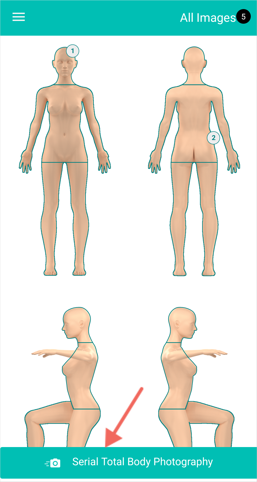 DermEngine  Total Body Photography