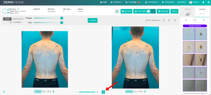 Autoscale image. KB article. How do I compare two images.-1