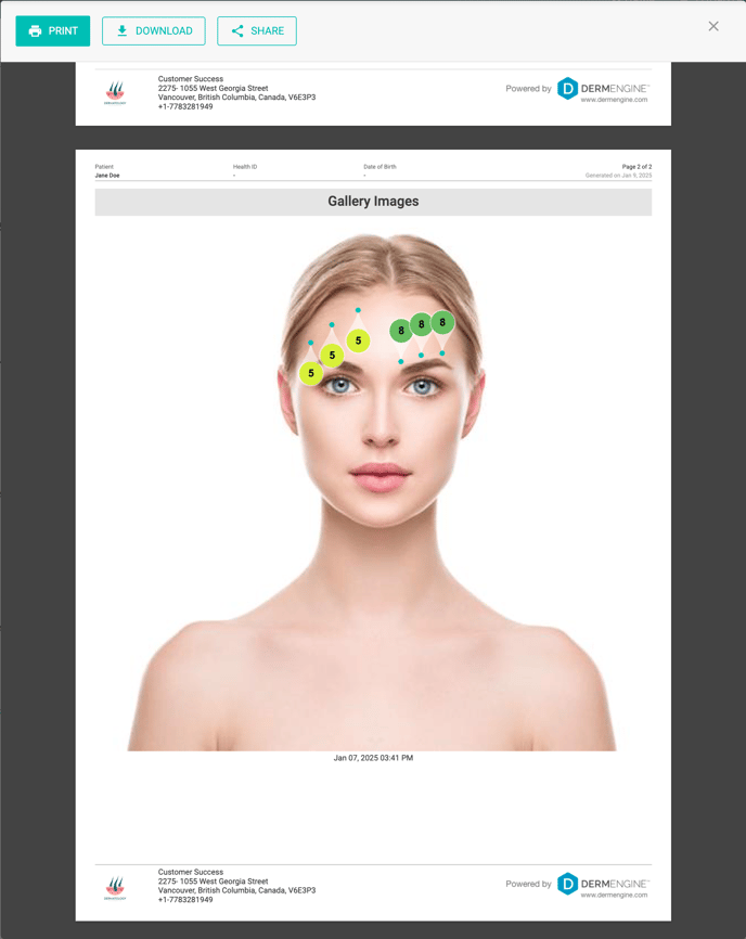 Gallery Images with Annotations. Injections. Print Report.