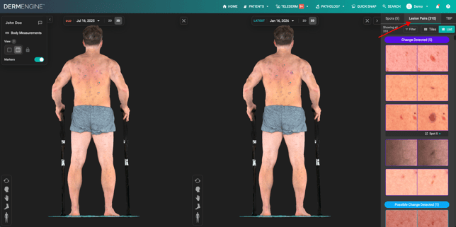 Comparison view