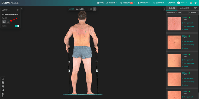 Default view