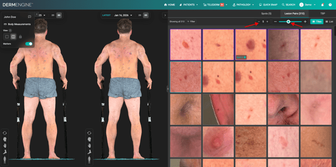 Adjusting tiles view