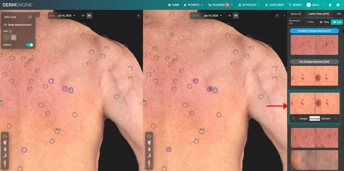 Marking lesion status