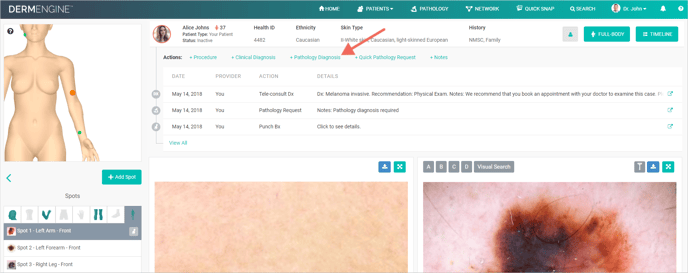 help.dermengine.comhcarticle_attachments3600054972332._Pathology_Diagnosis