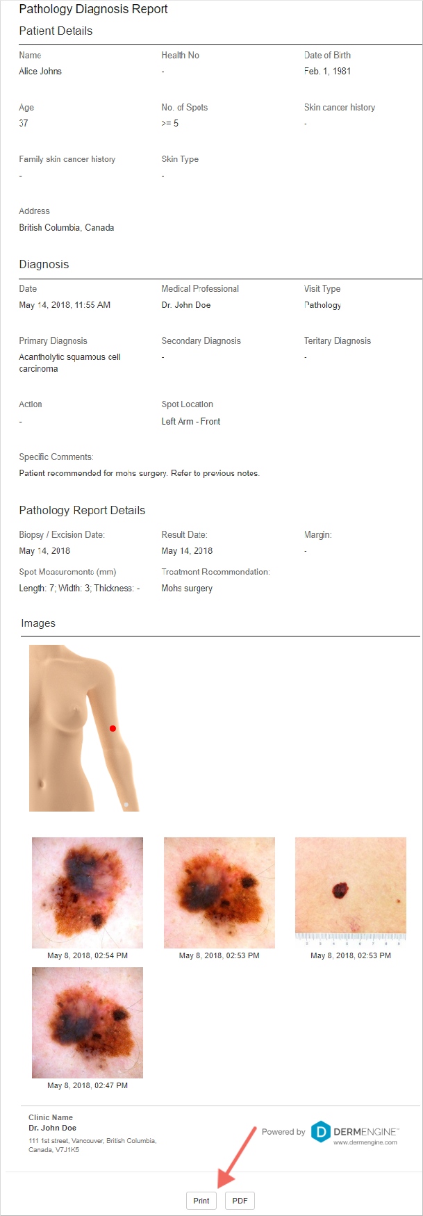 help.dermengine.comhcarticle_attachments3600054973137._pathology_report