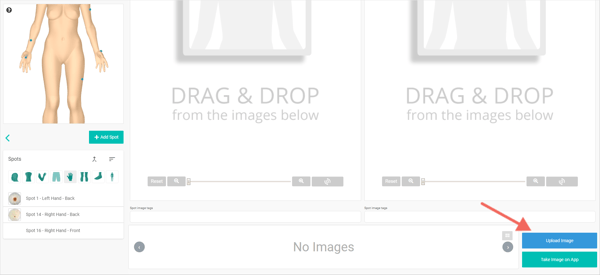 help.dermengine.comhcarticle_attachments360010902793Upload_image