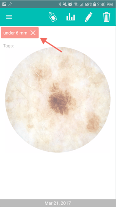 7._Remove_tags